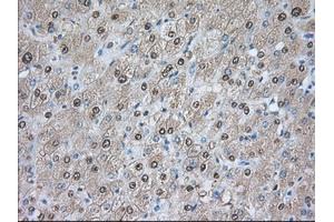 Immunohistochemical staining of paraffin-embedded Human prostate tissue using anti-PDE4A mouse monoclonal antibody. (PDE4A antibody)