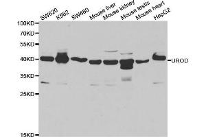 Western Blotting (WB) image for anti-Uroporphyrinogen Decarboxylase (UROD) antibody (ABIN1876681) (UROD antibody)