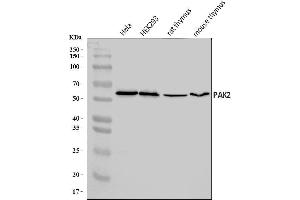 Western blot analysis of PAK2 using anti-PAK2 antibody (ABIN7599219).