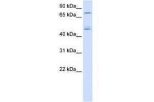 Image no. 1 for anti-DEAD (Asp-Glu-Ala-Asp) Box Polypeptide 1 (DDX1) (AA 36-85) antibody (ABIN6740488) (DDX1 antibody  (AA 36-85))