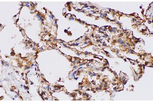 Immunohistochemistry of paraffin-embedded Human lung using FGA Polycloanl Antibody at dilution of 1:100 (FGA antibody)