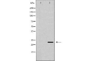 Western blot analysis of extracts of MCF7, using BAK1 antibody. (BAK1 antibody  (N-Term))