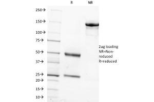 SDS-PAGE Analysis Purified FSH beta Mouse Monoclonal Antibody (FSHb/1062). (FSHB antibody)