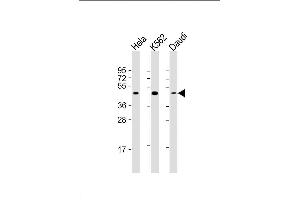 Lane 1: HeLa Cell lysates, Lane 2: K562 Cell lysates, Lane 3: Daudi Cell lysates, probed with PLIN3 (1651CT157. (PLIN3 antibody)