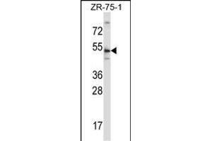 TERF2 Antibody (Center) (ABIN657781 and ABIN2846755) western blot analysis in ZR-75-1 cell line lysates (35 μg/lane). (TRF2 antibody  (AA 308-337))