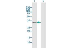 Western Blot analysis of PROCR expression in transfected 293T cell line by PROCR MaxPab polyclonal antibody.