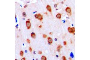 Immunohistochemical analysis of ALK1 staining in human brain formalin fixed paraffin embedded tissue section. (ACVRL1 antibody  (Center))