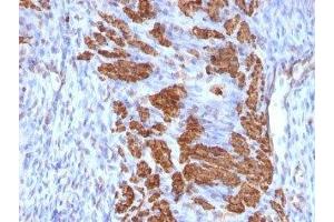 Formalin-fixed, paraffin-embedded rat uterus stained with Calponin antibody (CNN1/832 + CALP). (Calponin antibody)