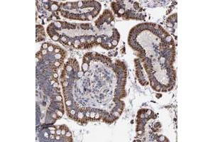 Immunohistochemical staining of human colon with EFR3A polyclonal antibody  shows srrong cytoplasmic positivity with granular pattern in glandular cells at 1:20-1:50 dilution. (EFR3A antibody)