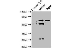 Immunoprecipitating MSLN in HepG2 whole cell lysate Lane 1: Rabbit control IgG instead of ABIN7159428 in HepG2 whole cell lysate.