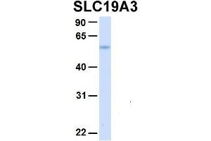 Host:  Rabbit  Target Name:  SLC19A3  Sample Type:  Human Fetal Liver  Antibody Dilution:  1. (SLC19A3 antibody  (Middle Region))