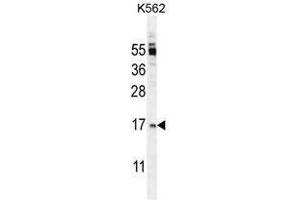 TNFSF4 Antibody (Center) western blot analysis in K562 cell line lysates (35 µg/lane). (TNFSF4 antibody  (Middle Region))