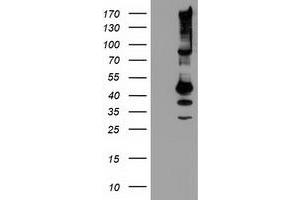 Western Blotting (WB) image for anti-serpin Peptidase Inhibitor, Clade B (Ovalbumin), Member 13 (SERPINB13) antibody (ABIN1500881) (SERPINB13 antibody)