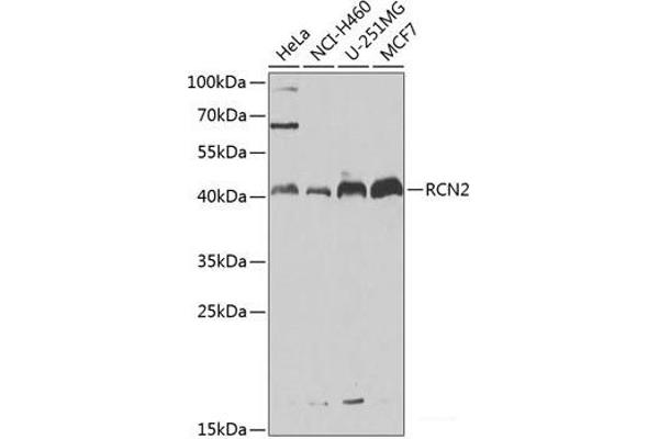 RCN2 anticorps