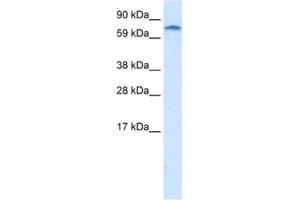 Western Blotting (WB) image for anti-Zinc Finger Protein 84 (ZNF84) antibody (ABIN2461187) (ZNF84 antibody)