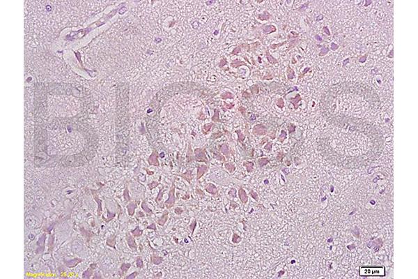 ITGB1 antibody  (AA 25-100)