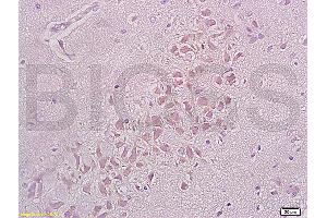 Formalin-fixed and paraffin embedded rat brain tissue labeled with Anti-Integrin beta 1/CD29 Polyclonal Antibody (ABIN669216), Unconjugated at 1:200, followed by conjugation to the secondary antibody and DAB staining