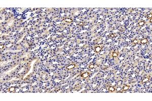 Immunohistochemistry (IHC) image for anti-Keratin 18 (KRT18) (AA 238-396) antibody (ABIN7433288)