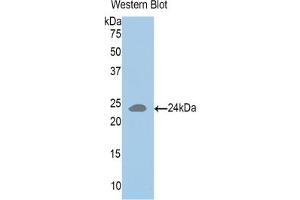 Detection of recombinant HLA-DRA using Polyclonal Antibody to HLA Class II Histocompatibility Antigen, DR Alpha Chain (HLA-DRA) (HLA-DRA antibody  (AA 26-216))