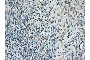 Immunohistochemical staining of paraffin-embedded colon using anti-Trim33 (ABIN2452535) mouse monoclonal antibody.