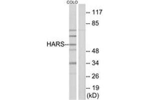 Western blot analysis of extracts from COLO cells, using HARS Antibody. (HARS1/Jo-1 antibody  (AA 460-509))