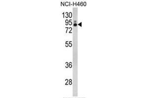 Western blot analysis of PLA2G4A Antibody (Center) in NCI-H460 cell line lysates (35ug/lane).