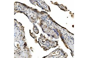 IHC analysis of VPRBP/DCAF1 using anti-VPRBP/DCAF1 antibody (ABIN7599063). (DDB1 and CUL4-Associated Factor 1 (DCAF1) (AA 1-195) antibody)