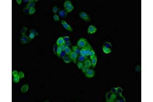 Immunofluorescent analysis of PC-3 cells using ABIN7158932 at dilution of 1:100 and Alexa Fluor 488-congugated AffiniPure Goat Anti-Rabbit IgG(H+L) (PRNP antibody  (AA 23-64))