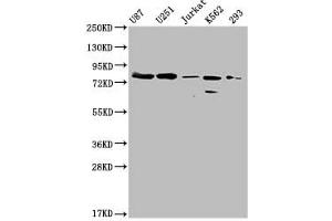 Western Blot Positive WB detected in: MMUT antibody at 1:1000 Lane 1: U87 whole cell lysate Lane 2: U251 whole cell lysate Lane 3: Jurkat whole cell lysate Lane 4: K562 whole cell lysate Lane 5: 293 whole cell lysate Secondary Goat polyclonal to Mouse IgG at 1/20000 dilution Predicted band size: 83 KDa Observed band size: 83 KDa Exposure time: 5 min (Histone 3 antibody  (AA 31-748))