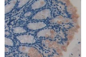 Detection of TTK in Mouse Colon Tissue using Polyclonal Antibody to TTK Protein Kinase (TTK) (Mps1 antibody  (AA 527-786))