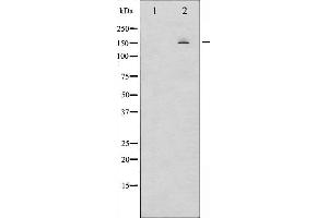 Western blot analysis of EGFR phosphorylation expression in TSA treated HeLa whole cell lysates,The lane on the left is treated with the antigen-specific peptide. (EGFR antibody  (pSer1026))