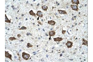 Image no. 1 for anti-Kv Channel Interacting Protein 2 (KCNIP2) (AA 22-71) antibody (ABIN6735459) (KCNIP2 antibody  (AA 22-71))