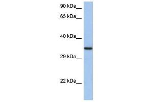 HORMAD2 antibody used at 1 ug/ml to detect target protein. (HORMAD2 antibody  (N-Term))