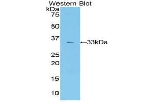 Western blot analysis of the recombinant protein. (IL20RA antibody  (AA 268-538))