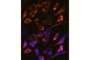 Immunofluorescence analysis of NIH-3T3 cells using SFRP4 Rabbit mAb (ABIN7270180) at dilution of 1:100 (40x lens). (SFRP4 antibody)