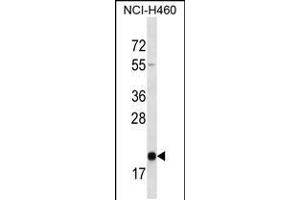 Western blot analysis in NCI-H460 cell line lysates (35ug/lane). (TMED2 antibody  (N-Term))