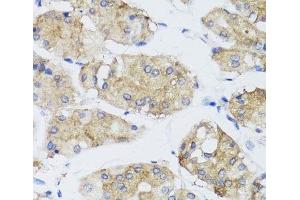 Immunohistochemistry of paraffin-embedded Human stomach using FGF13 Polyclonal Antibody at dilution of 1:100 (40x lens). (FGF13 antibody)