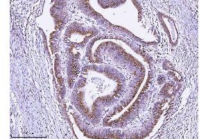 IHC analysis of ALDH3A1 using anti-ALDH3A1 antibody (ABIN7602181). (ALDH3A1 antibody  (AA 62-101))