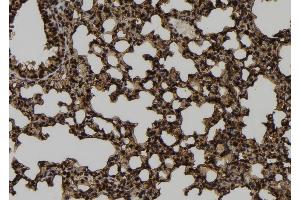 ABIN6273268 at 1/100 staining Mouse lung tissue by IHC-P. (MRFAP1 antibody  (Internal Region))