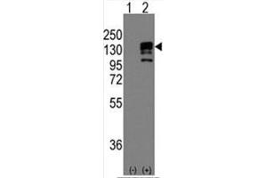 Image no. 2 for anti-Cadherin 1, Type 1, E-Cadherin (Epithelial) (CDH1) (N-Term) antibody (ABIN356994) (E-cadherin antibody  (N-Term))