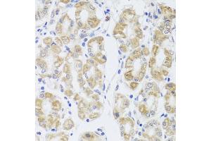 Immunohistochemistry of paraffin-embedded human stomach using MIP antibody (ABIN5971491) at dilution of 1/100 (40x lens). (MIP antibody)