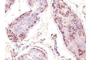 Formalin-fixed, paraffin-embedded human Testis stained with MAGE-1 Monoclonal Antibody (SPM282). (MAGEA1 antibody)