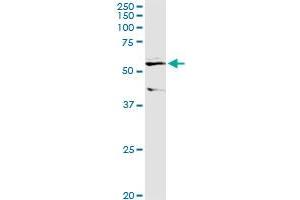 ALDH3B1 MaxPab rabbit polyclonal antibody. (ALDH3B1 antibody  (AA 1-431))