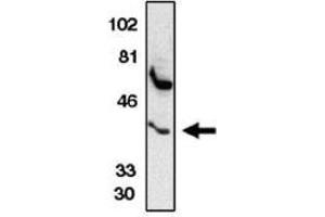 Image no. 1 for anti-Chemokine (C-C Motif) Receptor 5 (CCR5) (AA 6-20) antibody (ABIN265000) (CCR5 antibody  (AA 6-20))