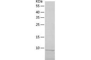 Western Blotting (WB) image for Chemokine (C-C Motif) Ligand 28 (CCL28) (AA 20-127) protein (His tag) (ABIN7289014) (CCL28 Protein (AA 20-127) (His tag))