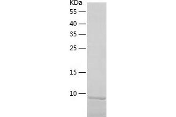 CCL28 Protein (AA 20-127) (His tag)