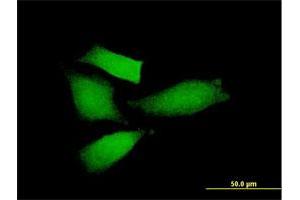 Immunofluorescence of purified MaxPab antibody to AMIGO2 on HeLa cell. (AMIGO2 antibody  (AA 1-522))