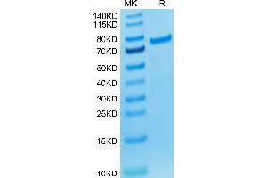 PAD4 Protein (AA 1-663) (His tag,Biotin)