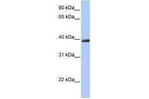 WB Suggested Anti-ZNF391 Antibody Titration:  0. (ZNF391 antibody  (N-Term))