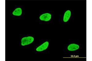 Immunofluorescence of monoclonal antibody to SGK1 on HeLa cell. (SGK1 antibody  (AA 1-90))
